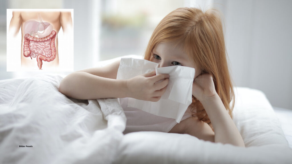 Allergie Leaky Gut