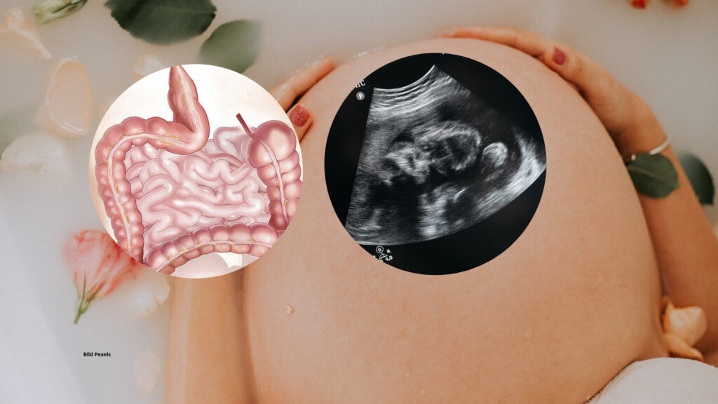 Schwangerschaft, Geburt und unsere Darmkeime