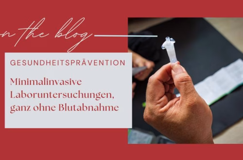 Labor ohne Blutabnahme